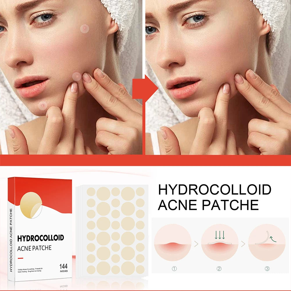 ClearCalm™ Pimple Patches ✨