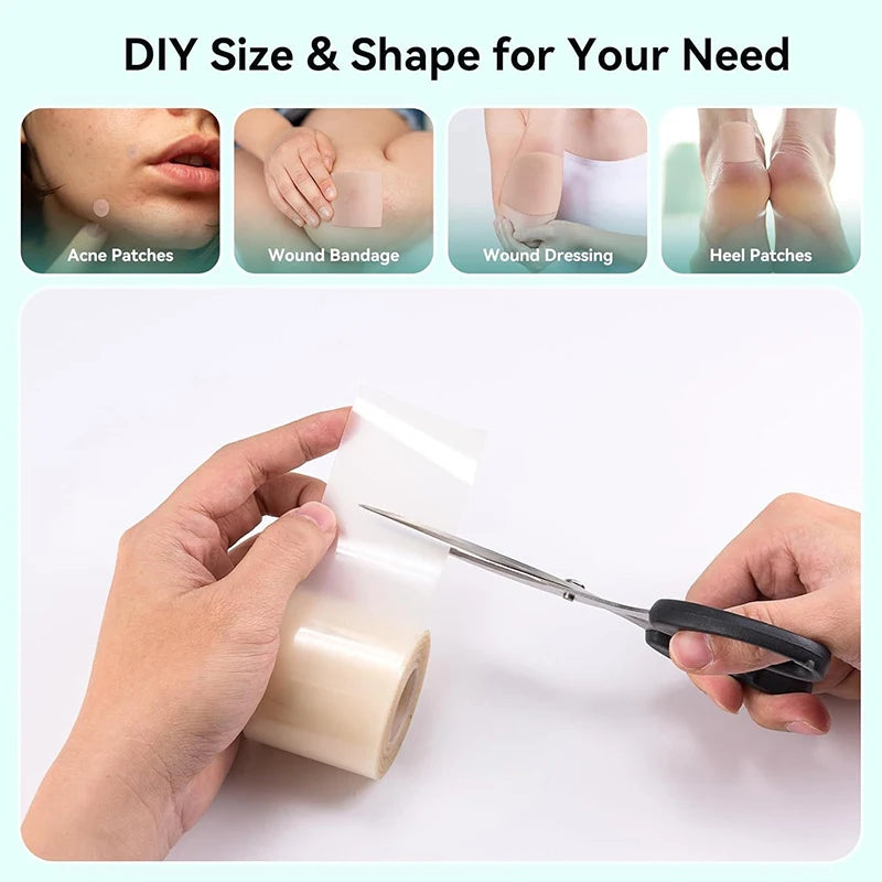ClearSkin Strip™ ✨ Hydrocolloid or Silicone Roll for Acne, Pimples & Scars