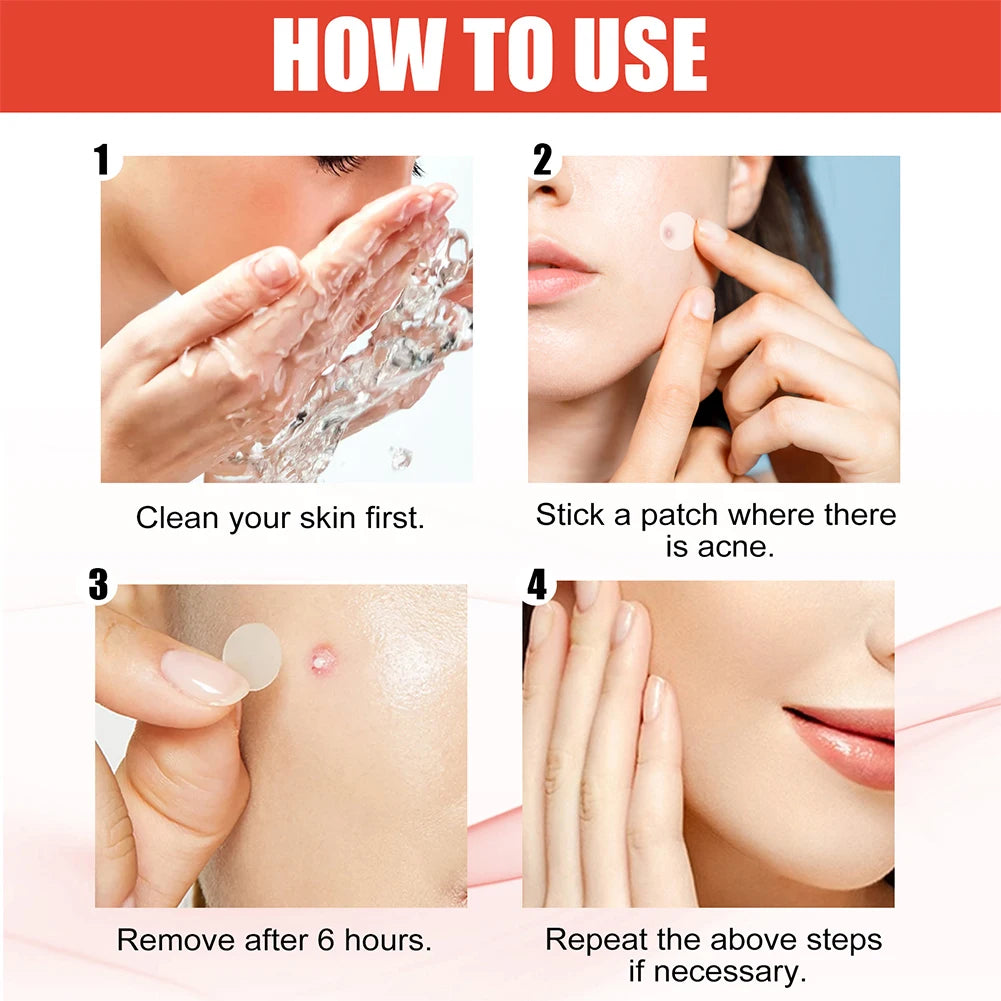 ClearCalm™ Pimple Patches ✨
