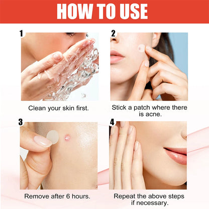 ClearCalm™ Pimple Patches ✨